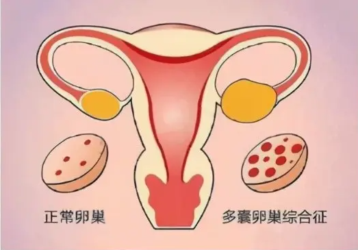 长春合法助孕qq群-长卵泡期方案并不适合所有人，适用于这些人